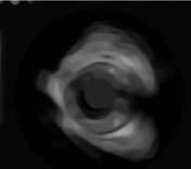 19: Longitudinal cut of IVUS (a), shape segmenting blood and tissue in (b) the original cut and the smoothed shape with RCF (d).