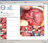 Real Time Outcomes for Congenital Heart Surgery: 2004 How to work with EMR s: We linked our electronic medical