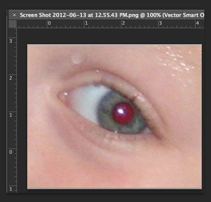 1. Open a photo you wish to correct. 2. Select the Zoom Tool from the Toolbox. Click and drag a rectangle around the eye (Figure 21). Figure 21. Red eye zoomed in 3.