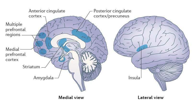 Brain regions that show the greatest activity during mindfulness practise
