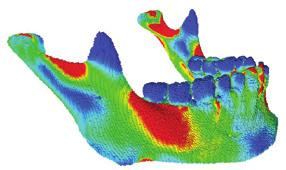 Modelling bone structure on HECToR VOX-FE is a complete, voxel-based finite element bone-modelling suite developed by Prof.
